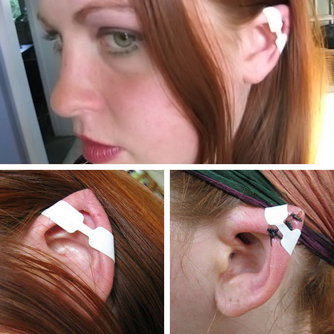 Ear Spiking;
This process involves carving a wedge of flesh and cartilage from  the upper portion of the ear, then stitching it back together allowing it to heal in its final "Spiked" shape.