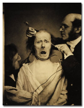 Guillaume-Benjamin-Amand Duchenne, a French neurologist who electrocuted his patients and recorded their facial expressions. His Simple explanation was that his research was the pursuit of knowledge.