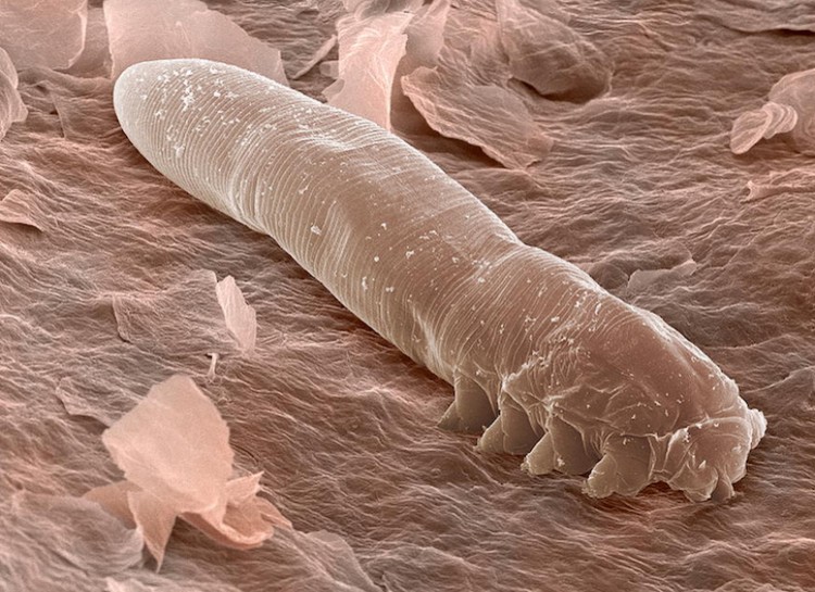 EYELASH MITES-The eyelash mite is a parasite found in the follicles of human faces, primarily in the nose, cheeks and most especially the eyelash area. They measure an incredible 0.012–0.016 inches long! They're pretty harmless to humans, but still, how gross is it that we live our daily lives with worm-like parasites feeding off our oils?!