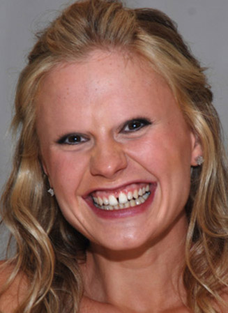 celebrities without teeth and eyebrows
