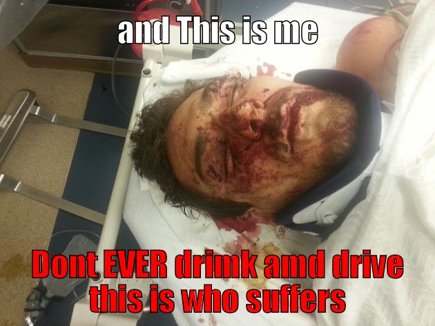 This is who Drunk Driving Hurts