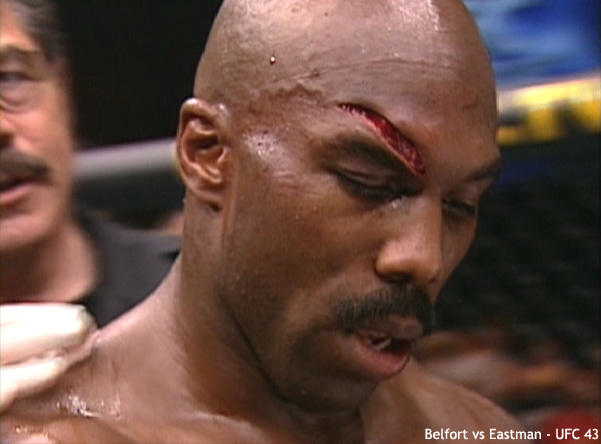Cuts from the world of MMA