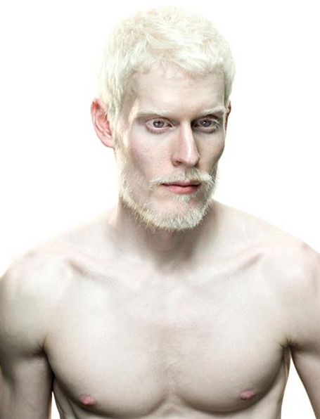 Melanistic vs. Albino