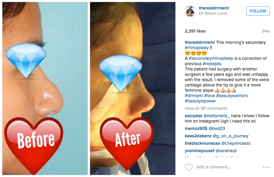Plastic Surgeon Posts Transformation Pics To Instagram