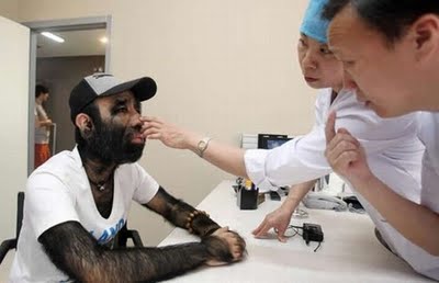 Chinese Chimp Man