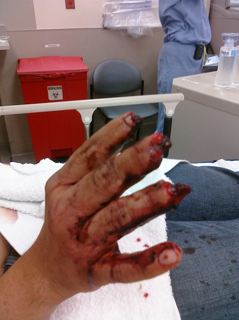 Don't grab on to a motorcycle chain