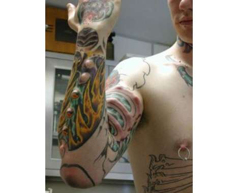 Cosmetic Implants and Raised Tattoos 