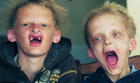I am not sure what is up with these kids but whatever it is, scares the crap outta me!!
