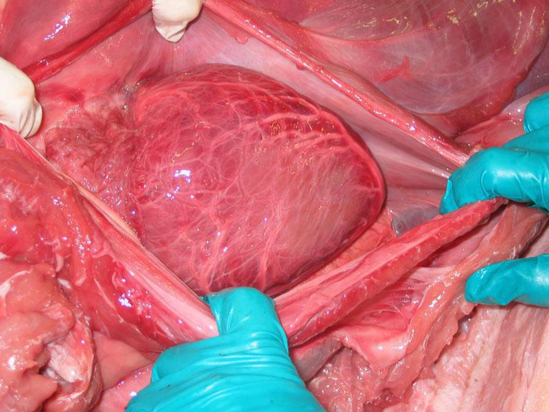 Human Heart