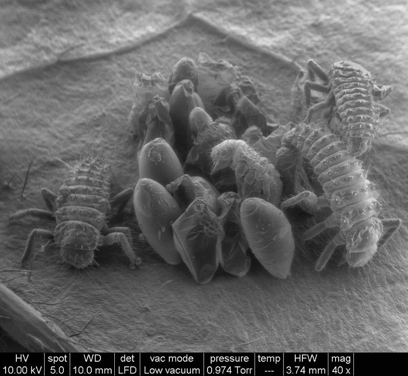 Birth of Ladybugs 40x magnification