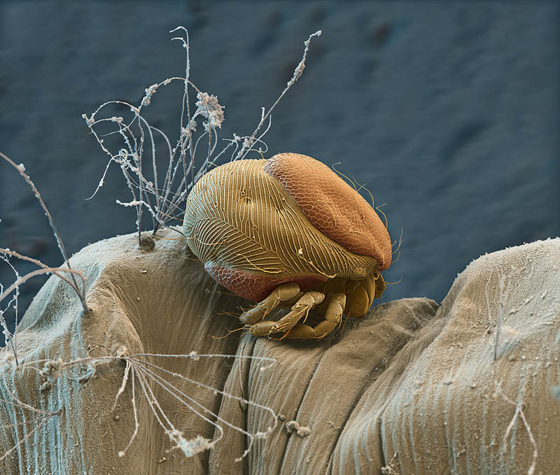 Parasitic Mite on Mosquito Larva 200x magnification