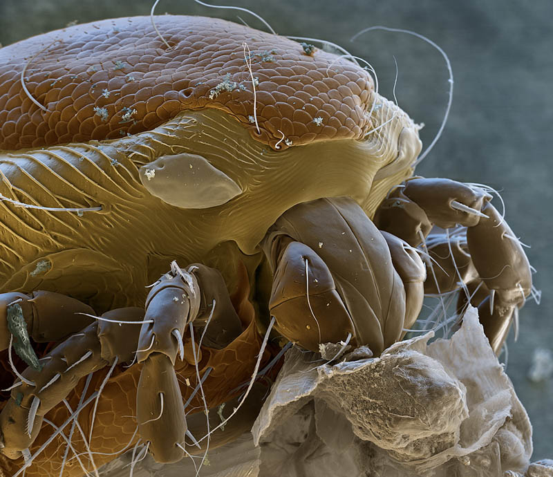 Water Mite 700x magnification