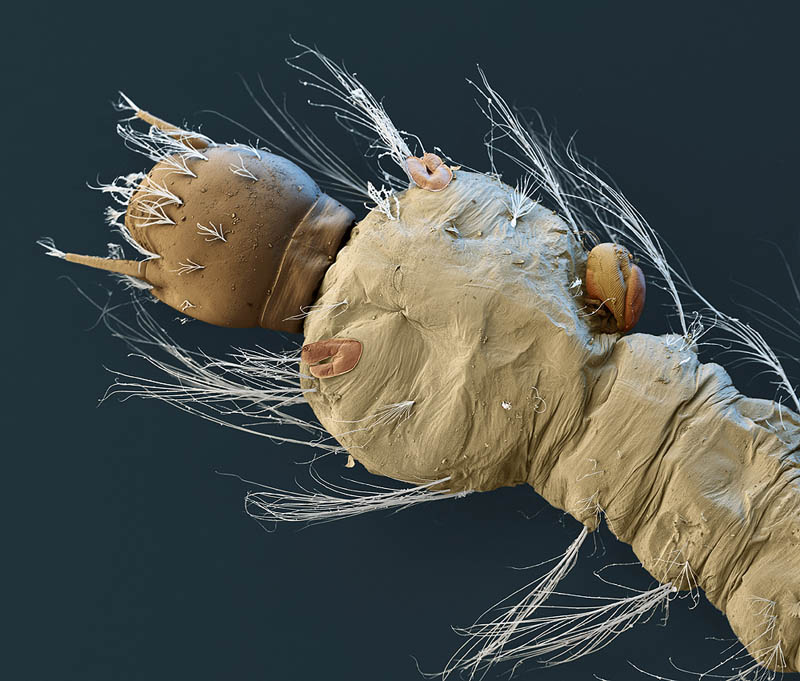 Mosquito Larva and Parasite 60x magnification