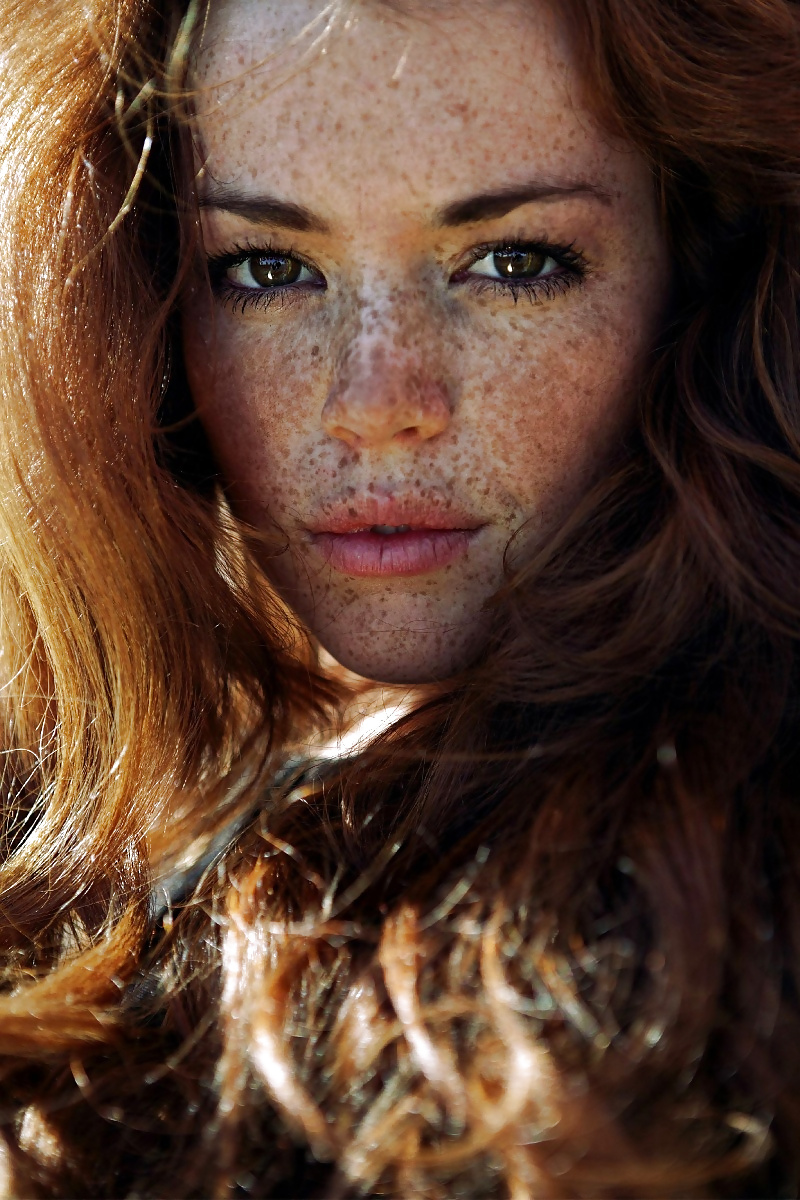 Freckles