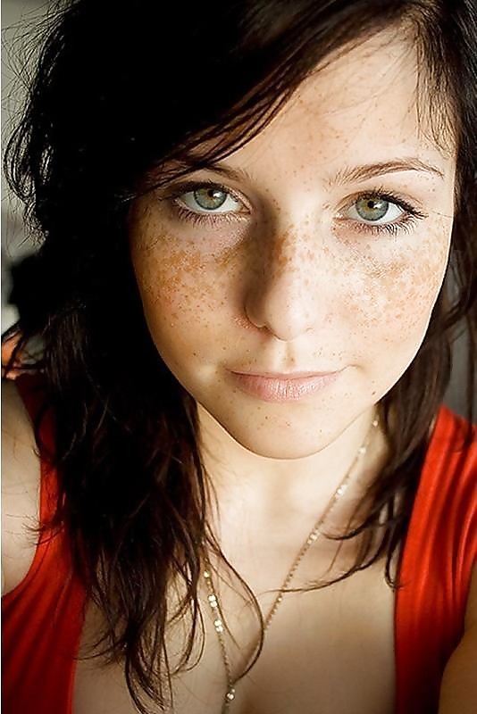 Freckles