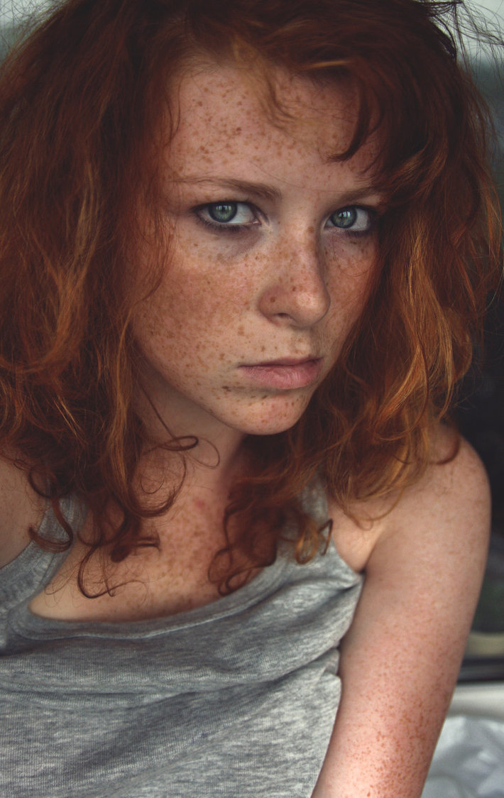 Freckles