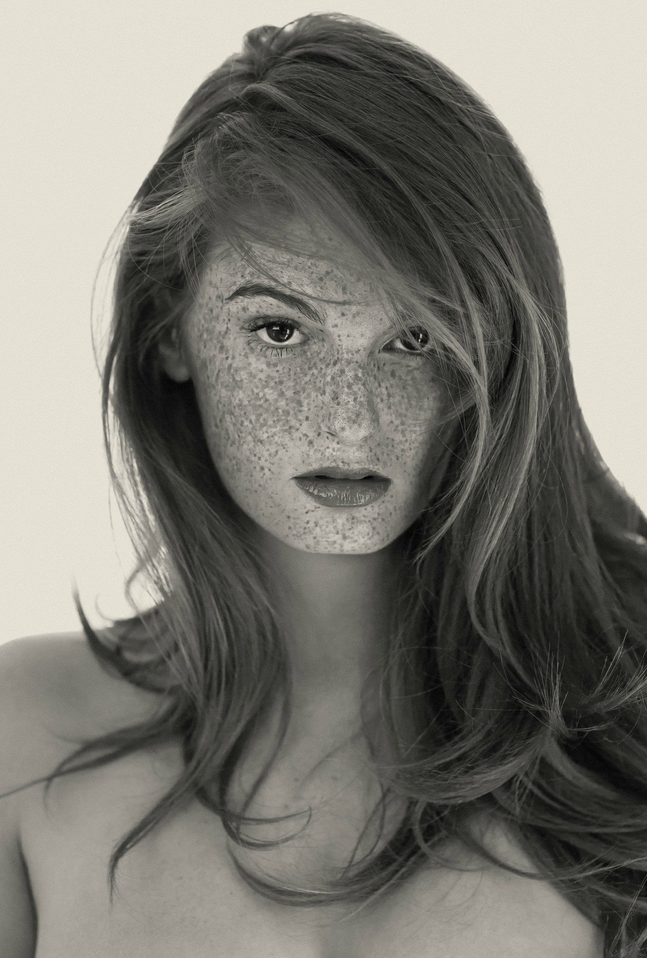Freckles