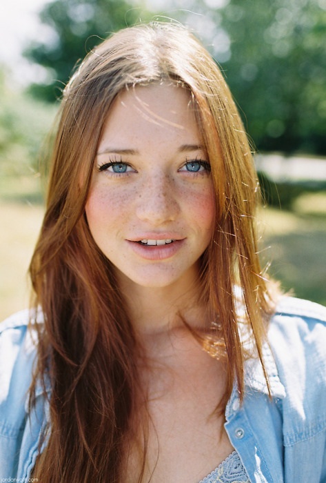 Freckles