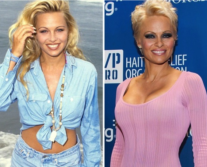 Pamela Anderson (C.J Parker)
The biggest star from Baywatch was also named a Playmate of the Month the year the show debuted. Pam continued using her hotness to secure acting roles, and she still looks great today, as evidence in a recent PETA ad where she stripped down naked.