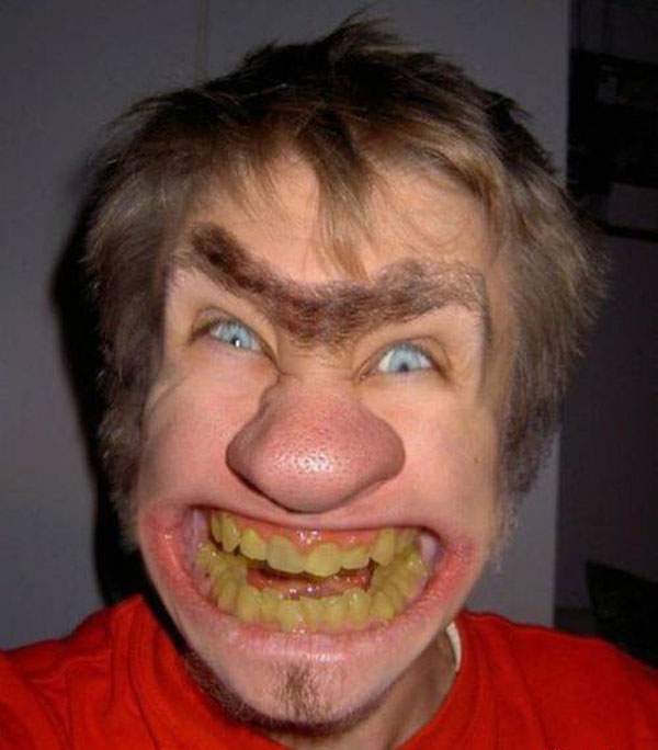 ugly people with yellow teeth