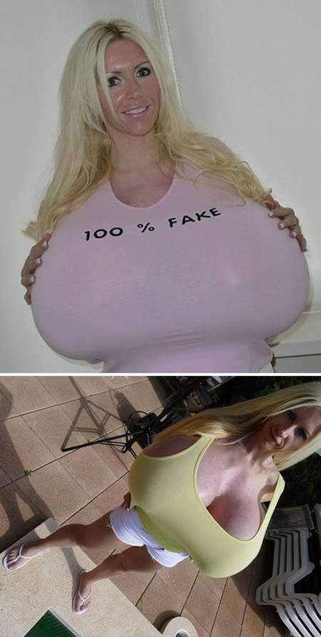 The woman with Europe's largest fake breasts.Beshine says that she doesn't suffer from backache due to a strict program of back strengthening but does struggle to find clothes that fit and, not surprisingly, can no longer sleep on her stomach, though apparently lying on her back or side is still possible.