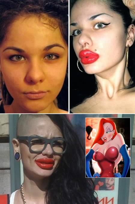 The Russian woman who had over 100 lip injections.A woman desperate to look like Jessica Rabbit has won the dubious honour of being in possession of the world's biggest lips after having 100 silicone injections. Kristina Rei, 22, was convinced her thin lips made her ugly so she opted to have them enlarged in the style of her favorite cartoon character, at a cost of more than £4,000.