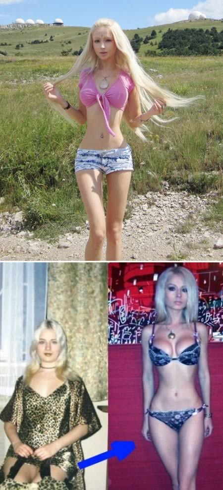 The Russian Barbie who supposedly had her ribs removed to have a smaller waist.Valeria Lukyanova is the self-proclaimed "most famous woman on the Russian-language internet". The 21 year-old Ukrainian first made a splash in her native Ukraine and neighboring Russia a few years back with her anime-style Barbie doll looks. After she first hit it big on the Russian-language internet, netizens started digging through her old social networking posts and profiles, cataloguing all the rumored surgeries she'd undergone—from nose jobs to rib removal. She certainly has a tiny waist.