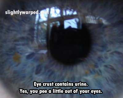 slightlywarped. Eye crust contains urine. Yes, you pee a little out of your eyes.