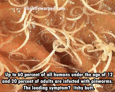 pinworm images humans - liginlywarpedlcom Up to 60 percent of all humans under the age of 12 and 20 percent of adults are infected with pinworms. The leading symptom? Itchy butt.