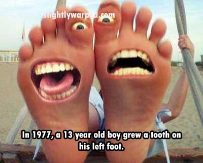 funny feet - slightlywarp.com In 1977, a 13 year old boy grew a tooth on his left foot.