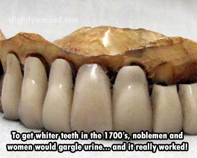 1940s dentures - To get whiter teeth in the 1700's, noblemen and women would gargle urine.. and it really worked!