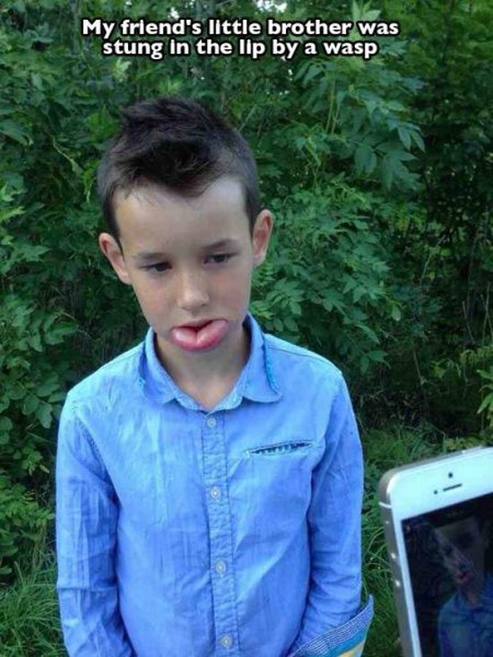 bad luck funny pictures of people having a bad day - My friend's little brother was stung in the lip by a wasp