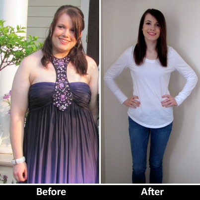before and after thyroid weight loss - Before After