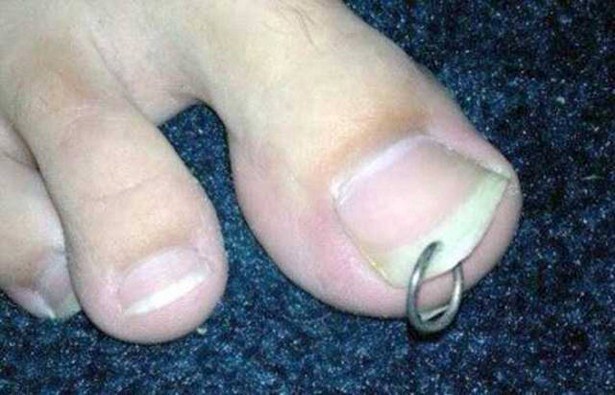 toe nail piercing