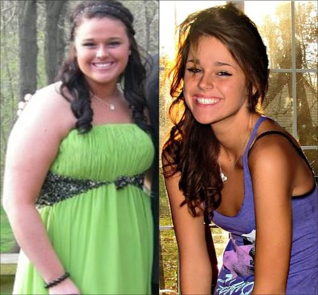 Incredible Weight-Loss Transformations That Will -