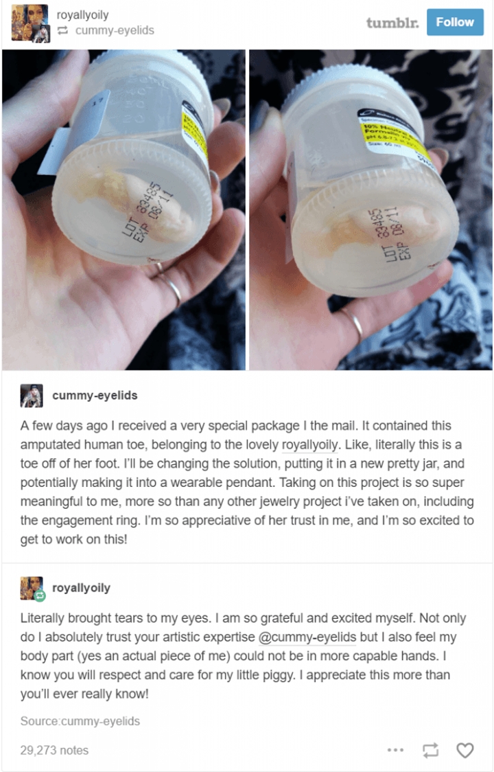 Woman Sends Fiance Her Pinky Toe To Make Into A Wearable Pendant