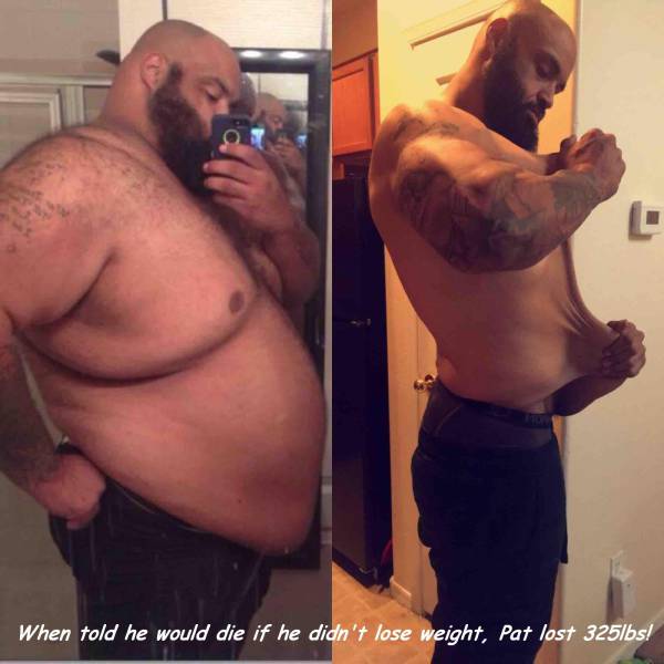 300 pounds man - When told he would die if he didn't lose weight, Pat lost 325lbs!