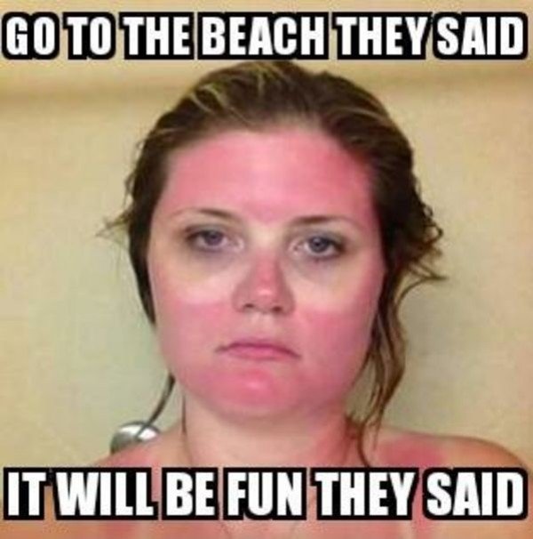 Beach meme of woman who went to the beach with googles on and now has strange tan lines.