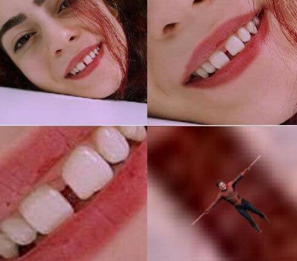 Woman smiling with massive gap between her teeth.