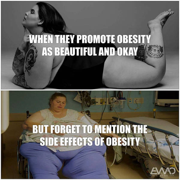 obesity is beautiful meme - When They Promote Obesity As Beautiful And Okay But Forget To Mention The Side Effects Of Obesity Awo