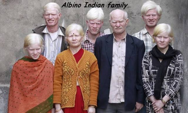 albino indian - Albino Indian family