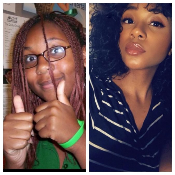 24 Uglies Who are Now Hotties 