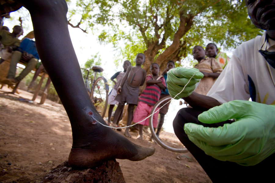 The Guinea Worm-Formally known as the Dracunculiasis, the Guinea worm is a microscopic larva carried by small water fleas. It makes its way to your tummy via contaminated drinking water or a not-so-refreshing swim, finds a comfy spot, and crashes for the next year and a half or so.

During this time the Guinea worm will grow 2-3 feet, or, for a more frightening example, to the height of a toddler.

When the worm has grown so large that a human belly is no longer a hospitable environment, it decides to bail. Burrowing upward, the worm makes its way to the skin’s surface, creating a blister that causes intense burning.

Apparently, the sneaky little snake is actually trying to get you to cool the burning sensation by submerging the painful area in water.

Its plan? To make a run for it and spread its larvae into a new body of water.. and start the process all over again.

So, to rid oneself of the Guinea worm, it’s recommended that one soak the blistered area in water, and sure enough, the disgusting bugger will pop his slimy head out, exit the body, and immediately release a “foul, milky brew into the water.”

The ‘milk’ contains hundreds of thousands more larva, which are then potentially ingested yet again by another very unfortunate human, dog, cat, wolf, coyote, jackal, fox, ferret, bear, or sea lion.