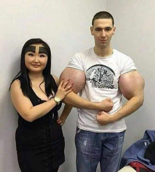 russian synthol kid