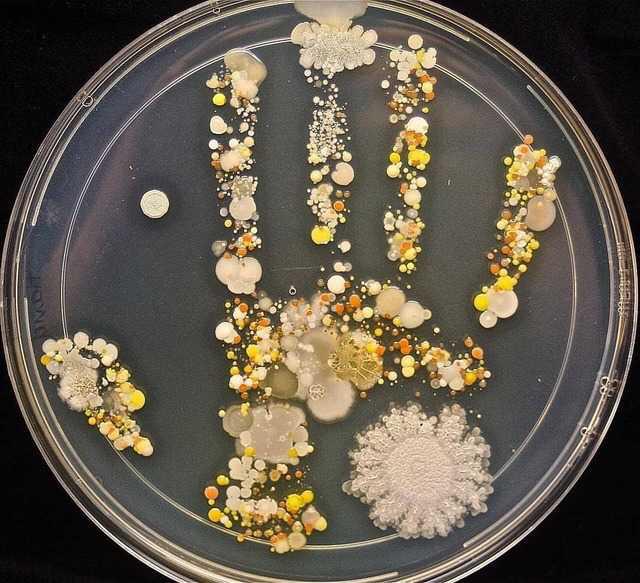 petri dish handprint