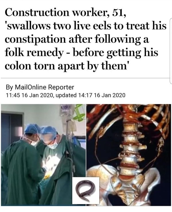 human behavior - Construction worker, 51, 'swallows two live eels to treat his constipation after ing a folk remedy before getting his colon torn apart by them' By MailOnline Reporter , updated e