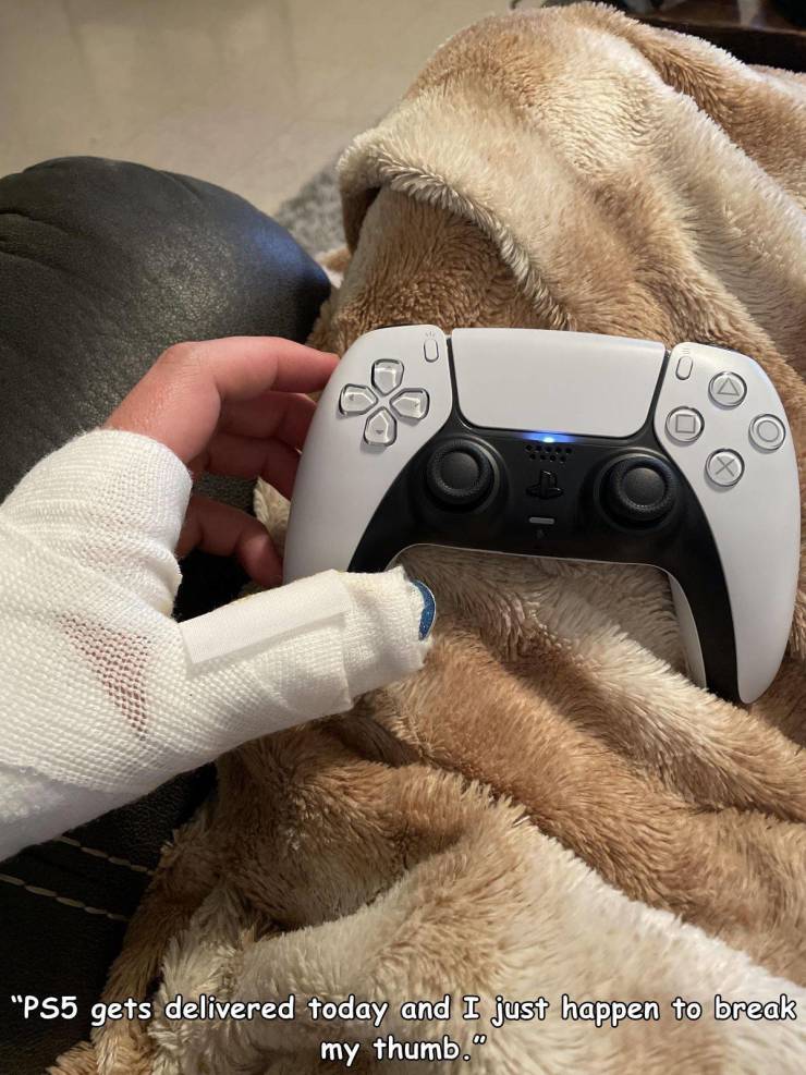 funny random pics - fur - "PS5 gets delivered today and I just happen to break my thumb."