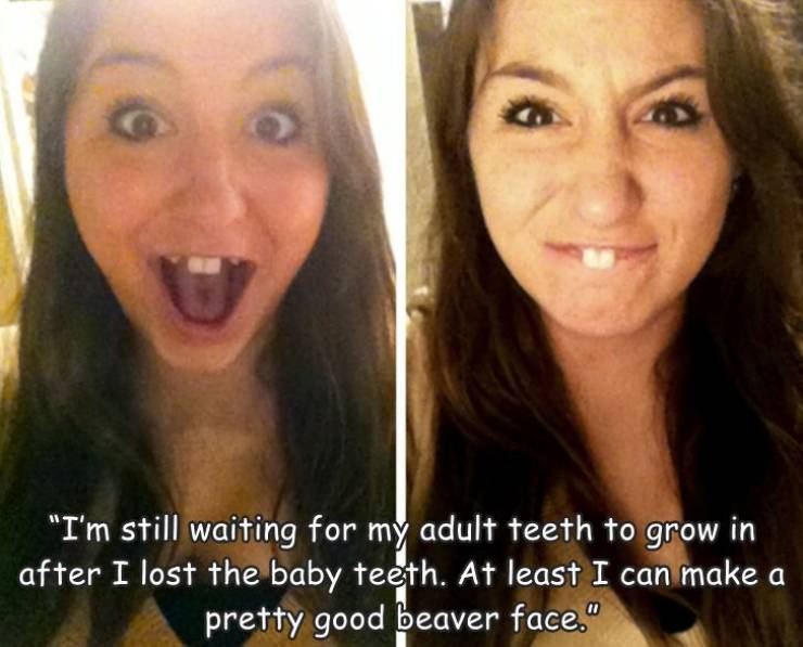 random pics - person beaver teeth - "I'm still waiting for my adult teeth to grow in after I lost the baby teeth. At least I can make a pretty good beaver face."