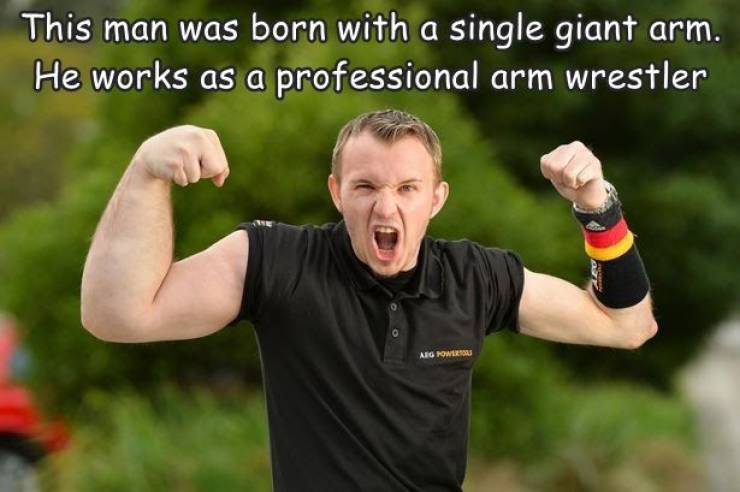 random photos - arm wrestling pro - This man was born with a single giant arm. He works as a professional arm wrestler Aig Now