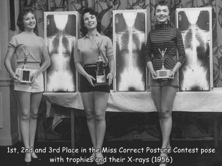 rare pictures of history - 1st, 2nd and 3rd Place in the Miss Correct Posture Contest pose with trophies and their Xrays 1956